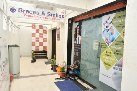 Braces Specialist In Pune | Dental Braces Cost In Pune